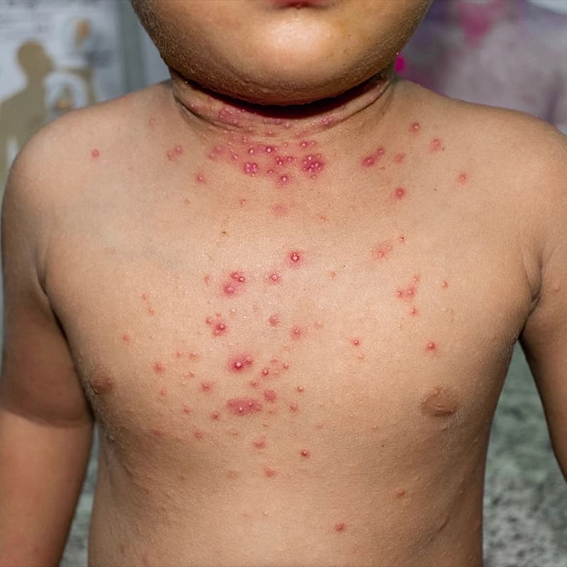 representation of patient state before treatment