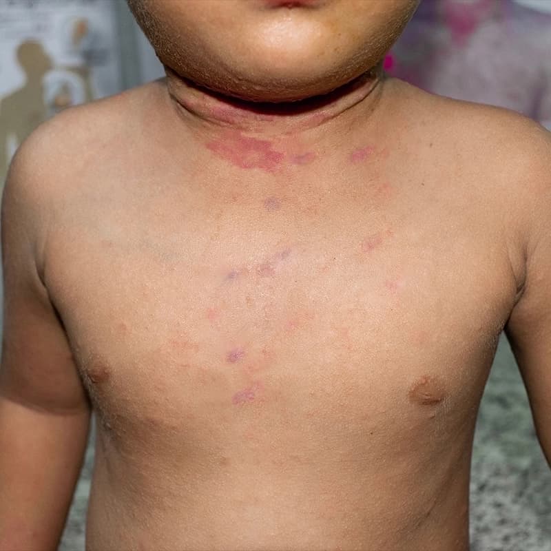 representation of patient state after treatment