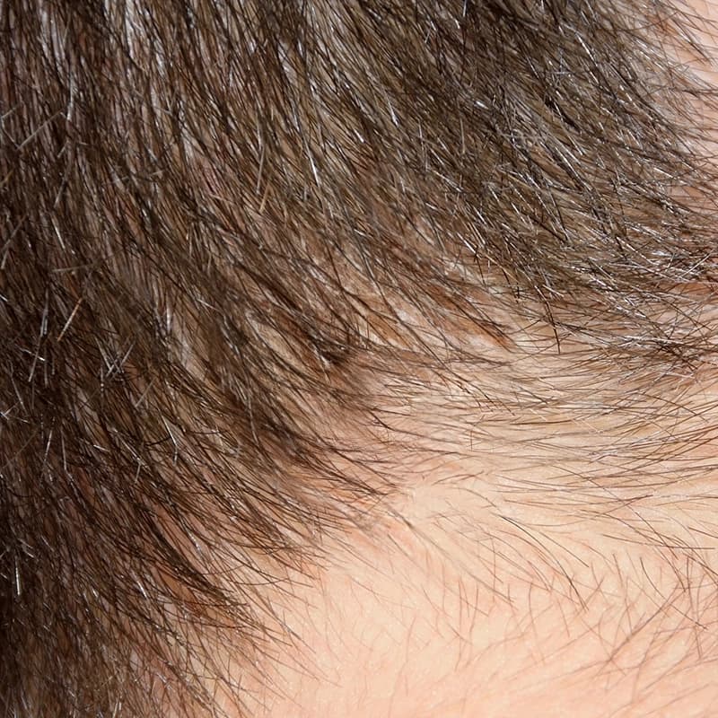 representation of patient state after treatment